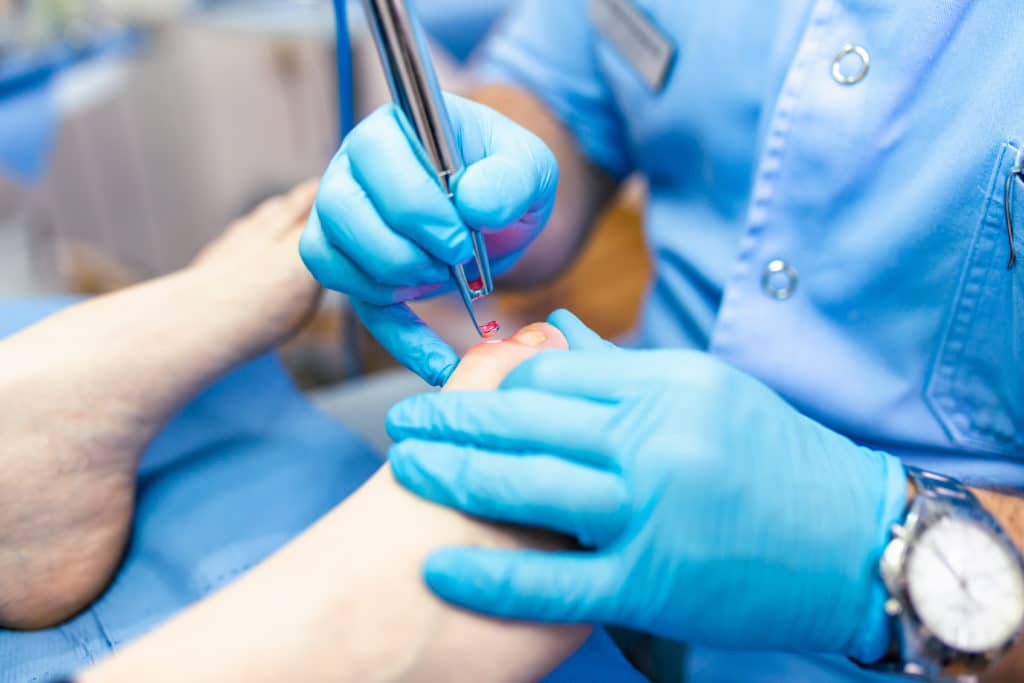 Arzt behandelt den Zehen eines Patienten mit einem Laser
