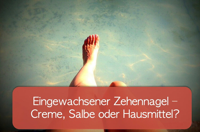 Read more about the article Eingewachsener Zehennagel mit Salbe oder Hausmittel behandeln?