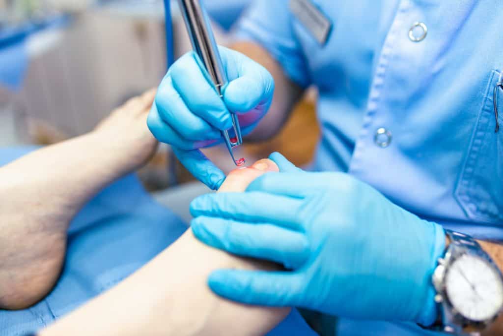 Arzt vollzieht eine Laserbehandlung am rechten Fuß eines Patienten.