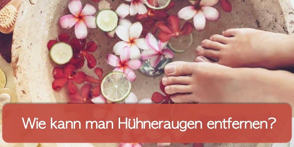 Read more about the article Hühnerauge entfernen – Diese Mittel gibt es!