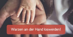 Read more about the article Warze an der Hand entfernen: Helfen Hausmittel?