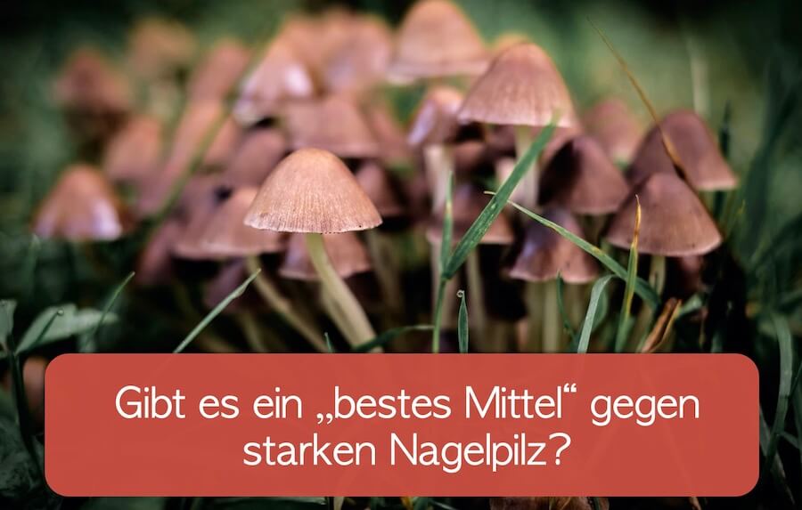 Read more about the article Bestes Mittel gegen starken Nagelpilz