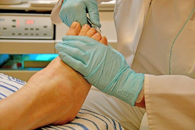 Medizinische Fußpflege Nagelpilz: Podologe behandelt Füße