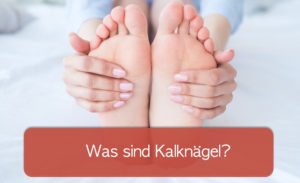 Read more about the article Kalknägel entfernen: Helfen Hausmittel?